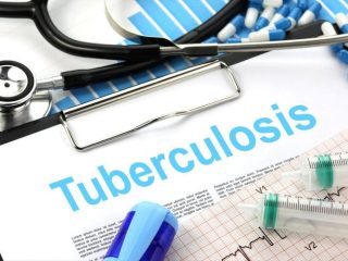 Salah satu tantangan dalam program nasional pengendalian TB adalah