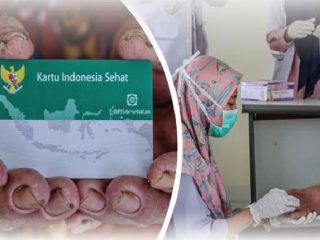 Scaling Gigi Bisa Pakai BPJS Kesehatan? Bagaimana Caranya? Jangan Lupa ada Persyaratannya